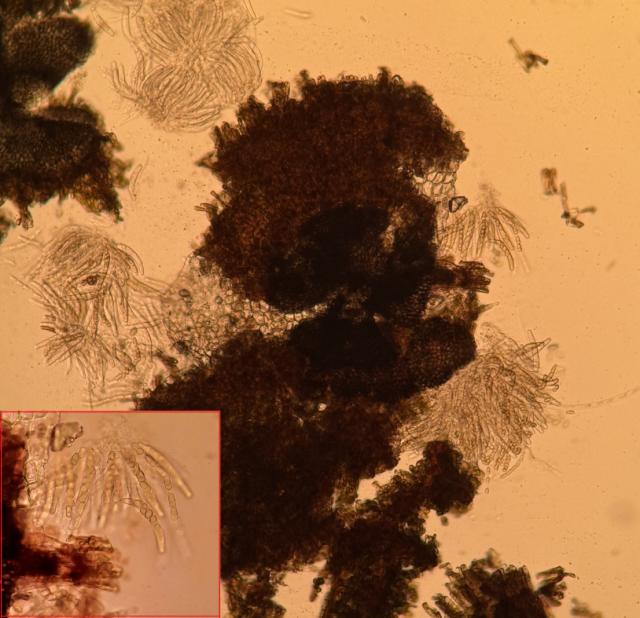 Venturia inaequalis, Čađava pegavost lišća i krastavost plodova jabuke	Apple scab
