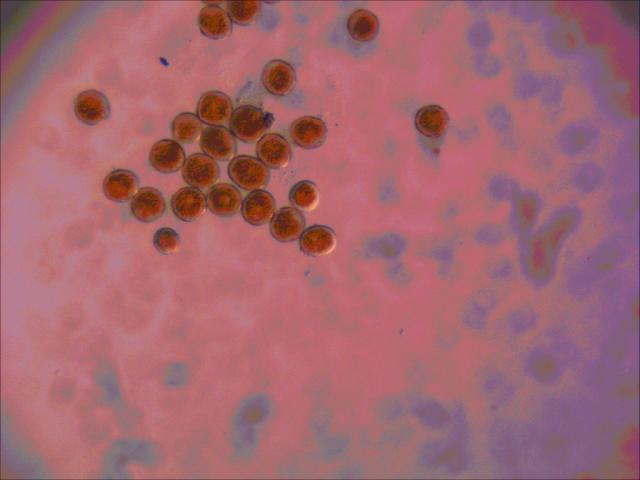 Puccinia spp. uredospore na travama