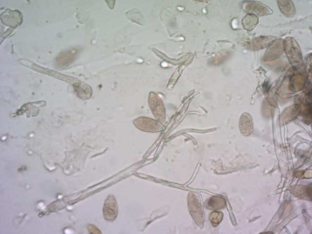 Peronospora destructor 